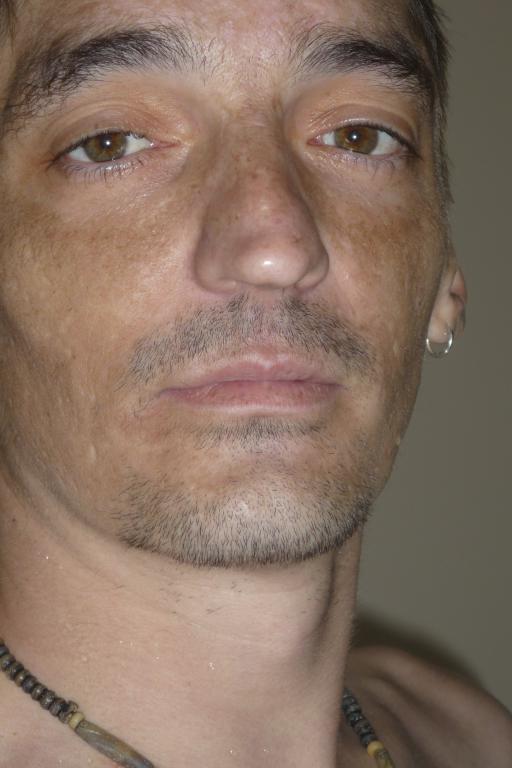 cedricallias