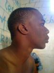 zipkha2