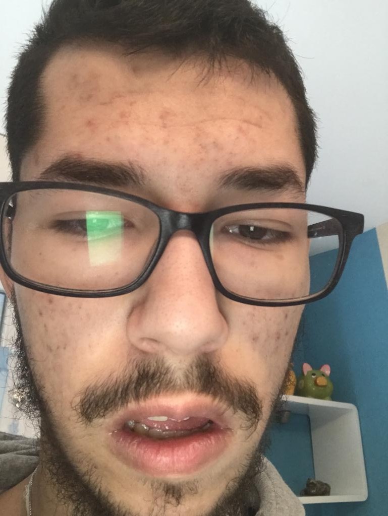 Jetdre22